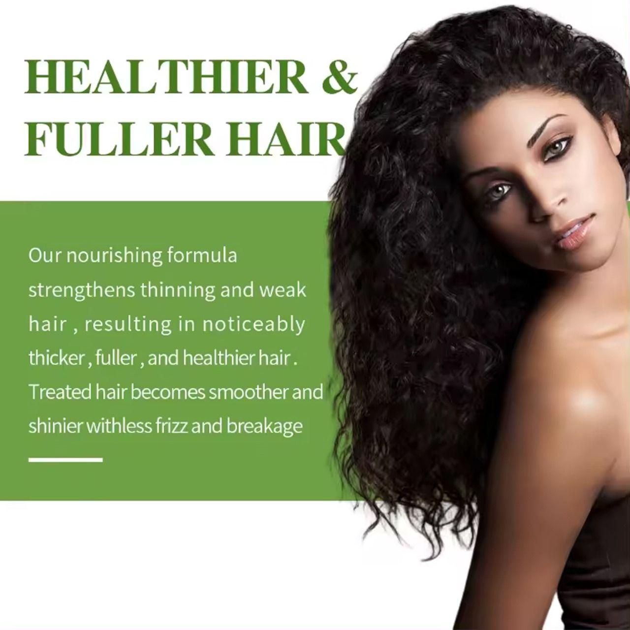 Hair Loss Treatment Serum 30Ml (Pack Of 1)